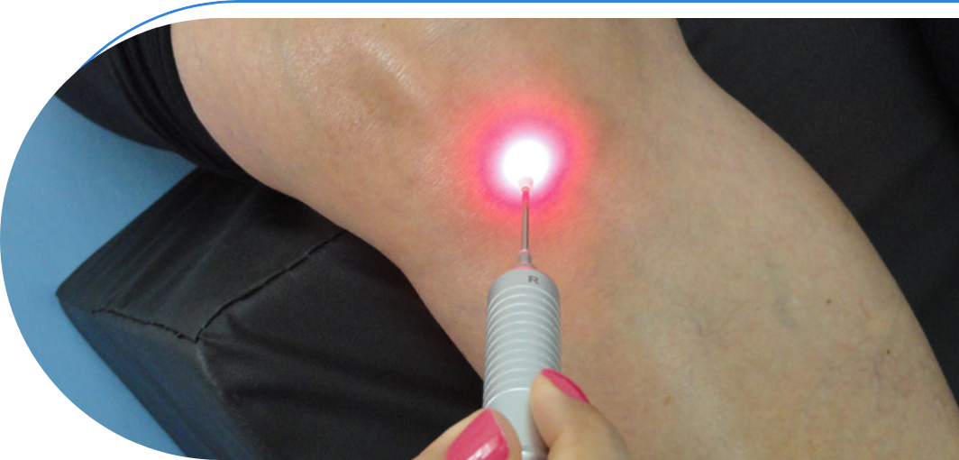 laserterapia